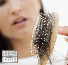 علامات تحذيرية ترافق تساقط شعرك تخفي مشكلات صحية خطيرة