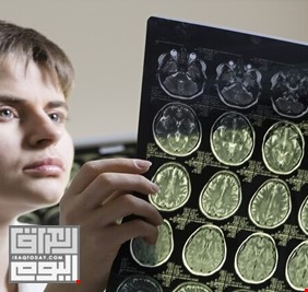 العلماء يكتشفون طريقة لتجديد شبابية الدماغ