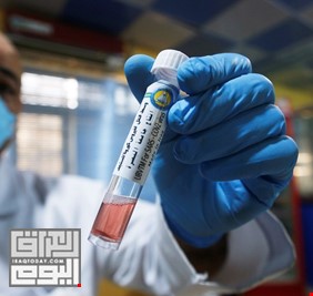 العراق يقوم بتجارب سريرية ناجحة لعلاج كورونا.. والصحة العالمية تؤكد ذلك