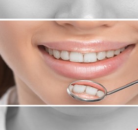 اكتشاف سبب غير متوقع لتسوس الأسنان وأمراض اللثة
