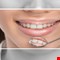 اكتشاف سبب غير متوقع لتسوس الأسنان وأمراض اللثة