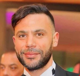 محمد إمام يحسم الجدل حول إجراء عمليات تجميل