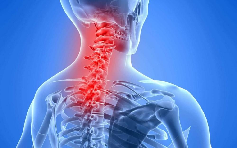 أسباب غير عادية لألم الرقبة