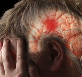 أعراض متكررة تشير إلى الإصابة بالسكتة الدماغية.. هكذا تقي نفسك منها