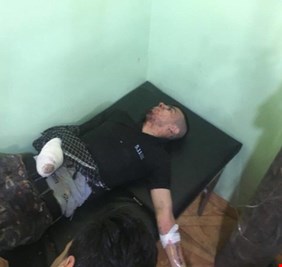 نجاة مقرر البرلمان  من قذيفة هاون ادت الى بتر يد ابنه