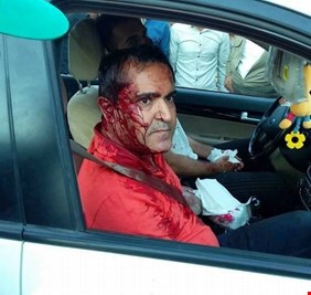 ضحية جديدة في مسلسل الإعتداءات على المرشحين .. اصابة رئيس قائمة في اربيل بجروح خطيرة