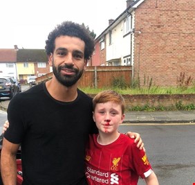 صورة لمحمد صلاح مع طفل تسيل الدماء من أنفه تشعل مواقع التواصل