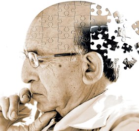 الزهايمر ... أدمغتنا آلاتٌ لغسل الصّحون !!