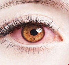 كيف تحمي عينيك من الضرر الناجم عن استخدام الهواتف الذكية؟