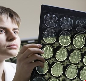 العلماء يكتشفون طريقة لتجديد شبابية الدماغ