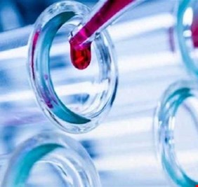 أول صينية تتعافى من “كورونا” تروي تجربة معاناتها وعلاجها وكيفية الوقاية