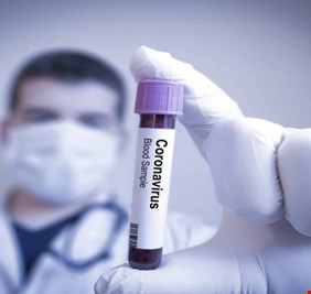 شركة أميركية تتحدث عن علاج محتمل لفيروس كورونا