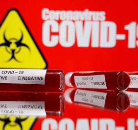 مسؤول حكومي: الولايات المتحدة تبدأ اليوم اختبارات سريرية للقاح ضد كورونا