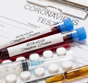 بشرى سارة .. أمريكا تجرب اليوم رسمياً لقاًحاً ضد فايروس كورونا