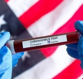 الولايات المتحدة تكشف نتائج آخر التجارب ضد كورونا : هذا “أفضل أمل”!