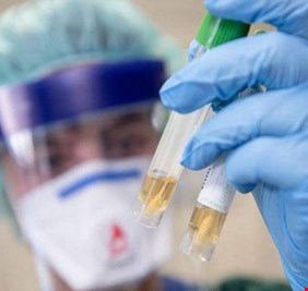 بسرعة غير مسبوقة.. قرب تجريب لقاح ضد كورونا