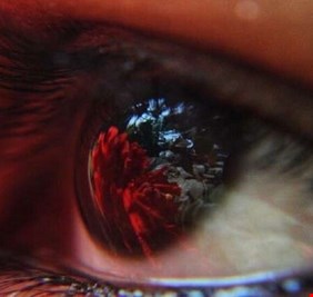 علامة في العين قد ينذر وجودها بخطر الإصابة بنوبة قلبية