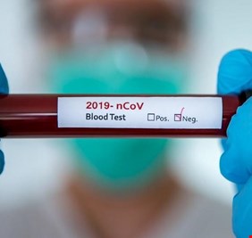 دراسة تكشف تكلفة علاج كورونا المحتمل