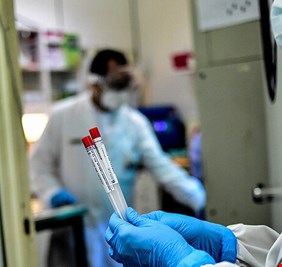 طبيب شهير: كورونا سينتهي ولا موجة ثانية