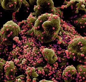 فريق علماء دولي يكشف عن ارتباط بين 