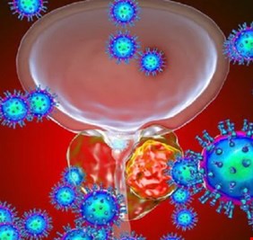 كيفية اكتشاف السرطان والسكري عن طريق الرائحة