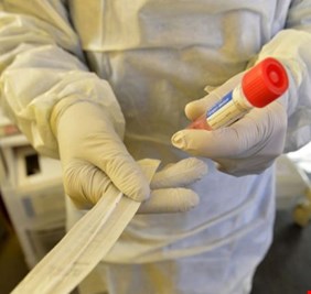 إيطاليا تسجل تراجعا في وفيات وإصابات كورونا