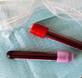 دراسة بريطانية: الرجال ينتجون أجساما مضادة لـ