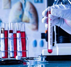 كورونا.. لقاح محتمل للفايروس مع نهاية العام