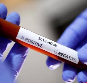 مستجدات كورونا: 3 دراسات تكشف عن “عارض جديد” لدى المصابين،، وحقيقة فصيلة الدم “الحديدية”