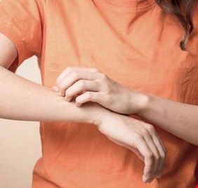 أبرزها أشعة الشمس .. 5 علاجات بسيطة لمرض الصدفية