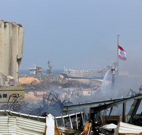 في اليوم الأول من2021 لبنانية تستيقظ من غيبوبتها بعد 5 أشهر من إصابتها في انفجار مرفأ بيروت