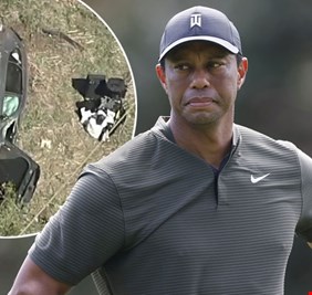 أسطورة الغولف تايغر وودز يتعرض لإصابات خطيرة في قدميه إثر حادث سير