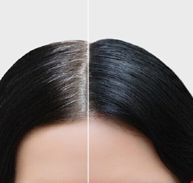 الشيب ليس دائما علامة شيخوخة بل قد يكون لأسباب 