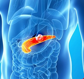 طبيب روسي يكشف عادات تقتل البنكرياس