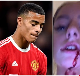 تطور جديد في قضية اعتداء نجم مانشستر يونايتد على صديقته