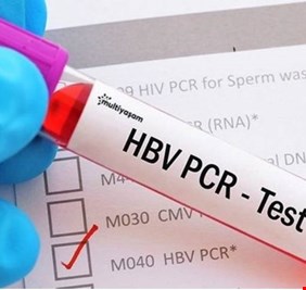 تماثلاً مع إجراءات الدول المتقدمة.. العراق يستغني عن فحوصات 