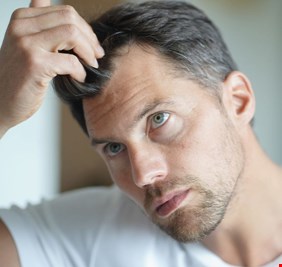 لماذا يتساقط شعر الرجل؟
