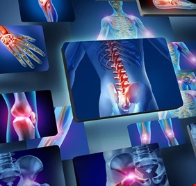 التهابات المفاصل تؤثر على العينين.. حقيقة أم خرافة؟