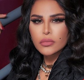 إصابة أحلام بكسر في يدها