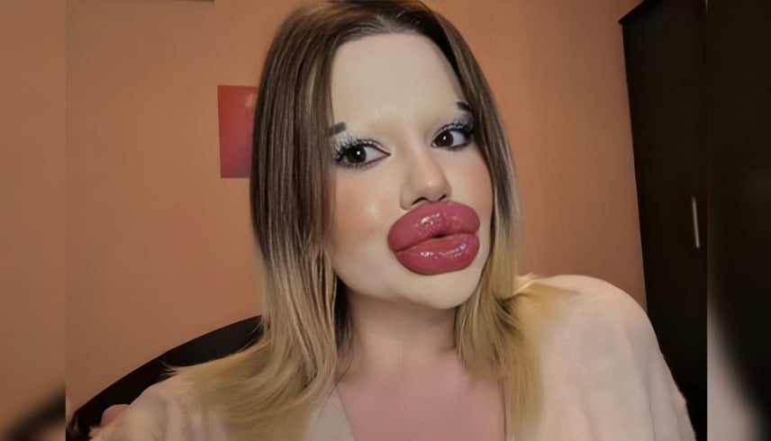 تلقت 32 حقنة.. صاحبة 