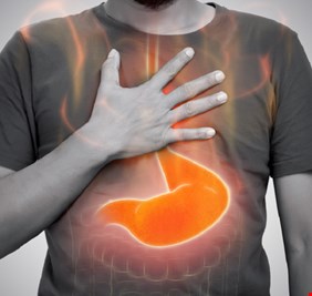 أسباب غير متوقعة لحرقة المعدة