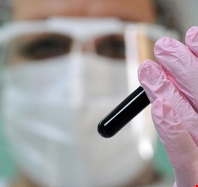 مخاوف من جائحة جديدة بعد اكتشاف فيروس 